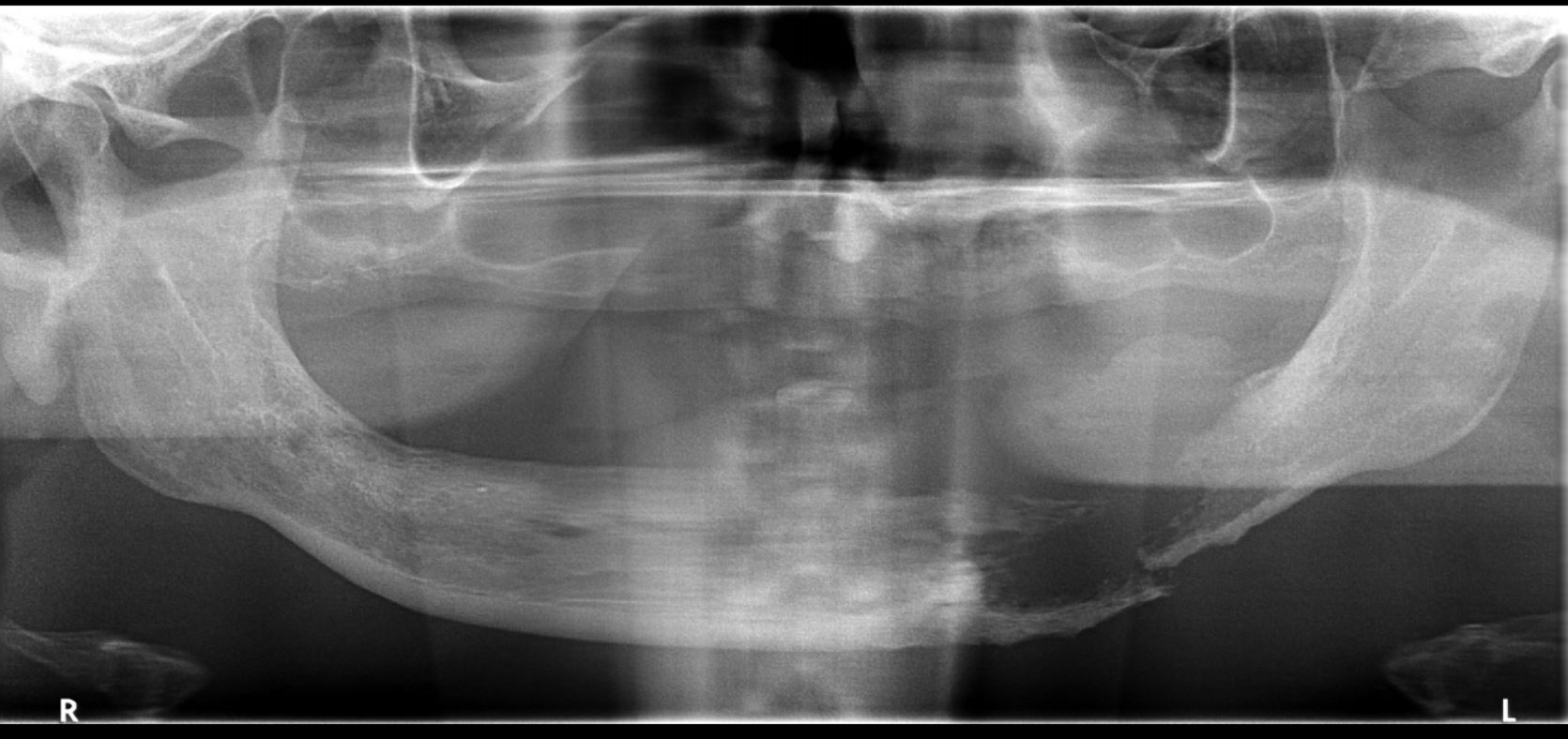 Case 17